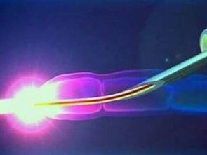 Laser v službi